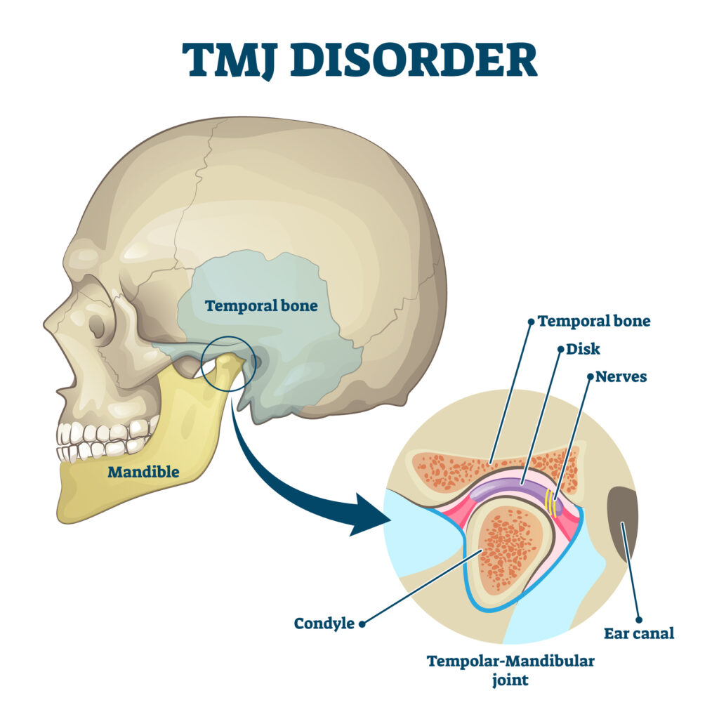 TMJ Specialist San Antonio